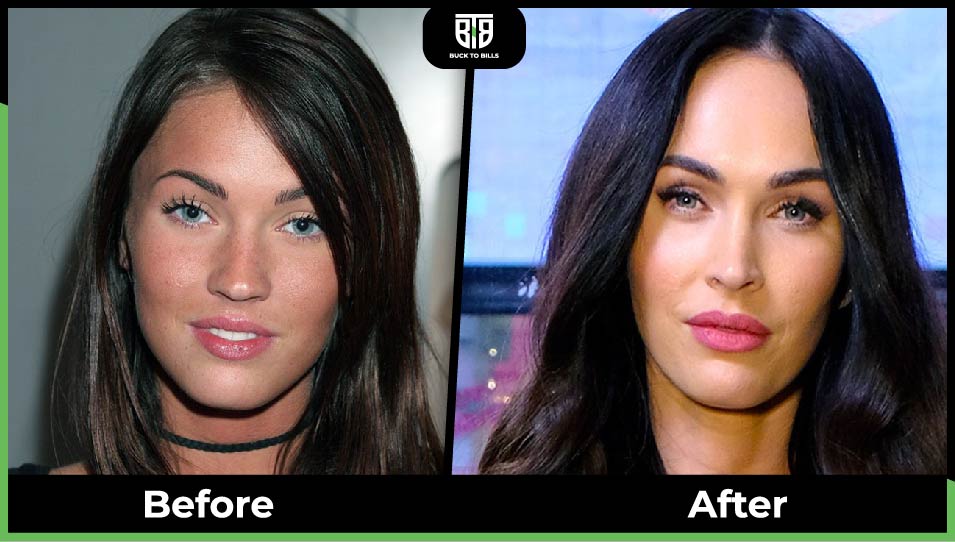 Megan Fox’s plastic surgery